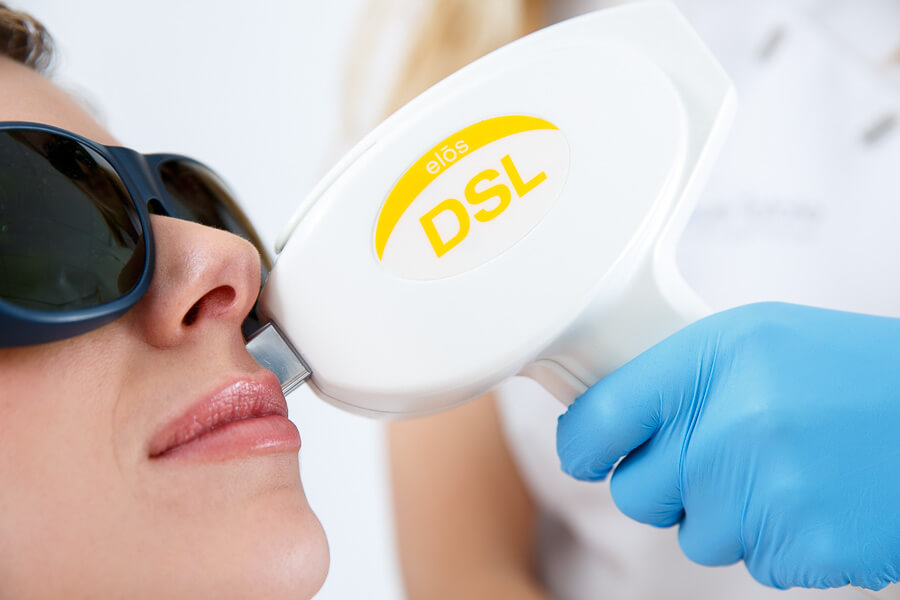 8 redenen om IPL-laserbehandeling te overwegen