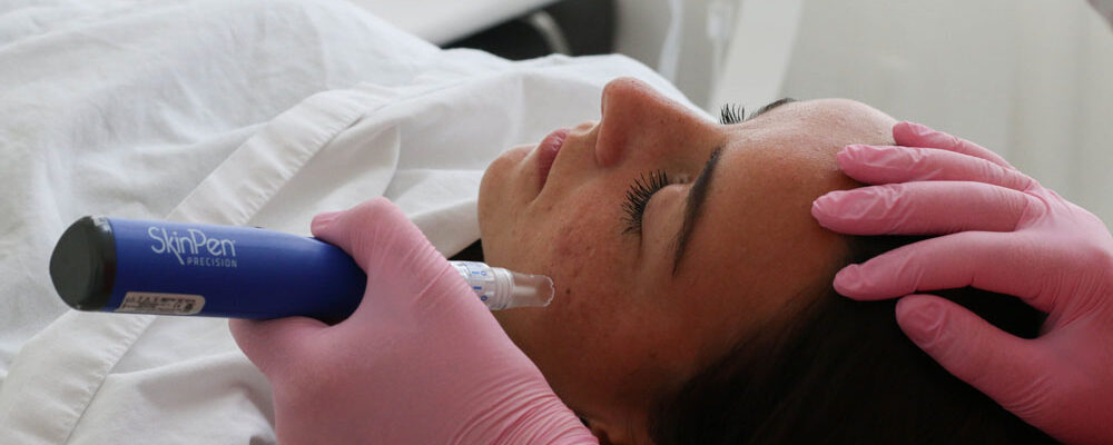 Eerste keer gezichtbehandeling