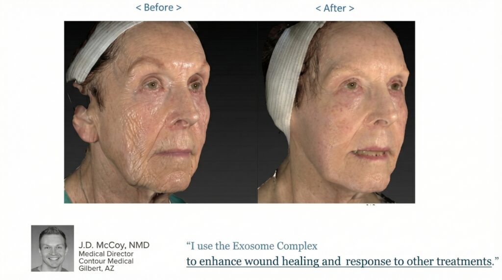 Exosomes-before-and-after-_new2